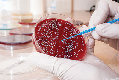 Staphylococcus aureus Infections - Infections - Merck ...